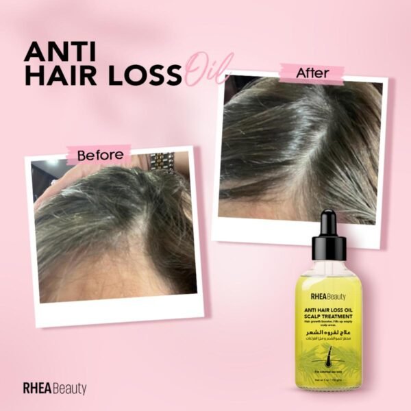 Rhea Beauty anti hair loss oil ( rosemary oil) – authentic in Egypt